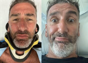 Incidente choc in moto per Corrado Sorrentino: “Sono rotto, grazie a chi mi ha salvato”