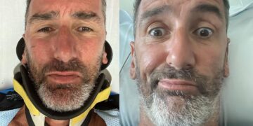 Incidente choc in moto per Corrado Sorrentino: “Sono rotto, grazie a chi mi ha salvato”