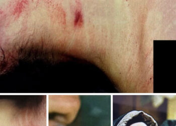 Manuela Murgia, le immagini choc:”Quando la vittima non può più parlare, è il suo corpo a raccontare la verità”