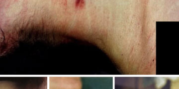 Manuela Murgia, le immagini choc:”Quando la vittima non può più parlare, è il suo corpo a raccontare la verità”