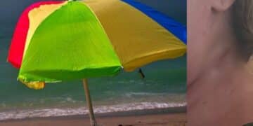 Chia, donna colpita da un ombrellone volato via a causa del forte vento