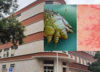 Cagliari, casi di scabbia all’istituto superiore: le rassicurazioni della scuola non bastano