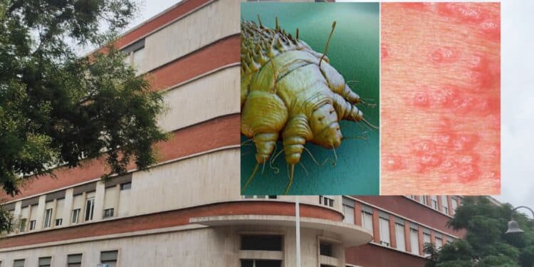 Cagliari, casi di scabbia all’istituto superiore: le rassicurazioni della scuola non bastano