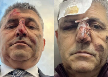 Incidente sull’Asse Mediano per l’imprenditore Stefano Lai: “Se non si fossero fermati non sarei qui, grazie a tutti per la gentilezza”