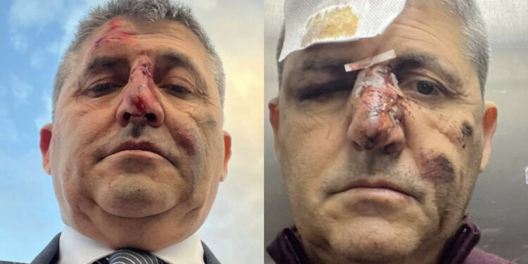 Incidente sull’Asse Mediano per l’imprenditore Stefano Lai: “Se non si fossero fermati non sarei qui, grazie a tutti per la gentilezza”