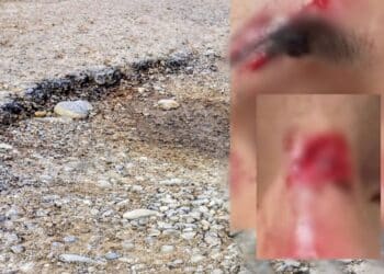 Assemini, buche trappola per pedoni e ciclisti: un ragazzo al pronto soccorso