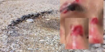 Assemini, buche trappola per pedoni e ciclisti: un ragazzo al pronto soccorso