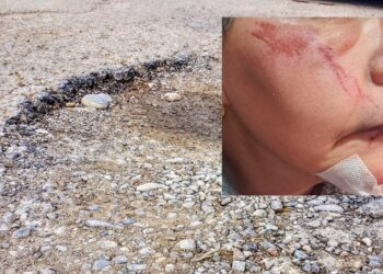 Assemini, disabile cade per colpa del marciapiede danneggiato: “Grazie a tutti quelli che mi hanno aiutato”