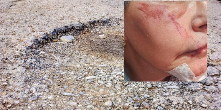 Assemini, disabile cade per colpa del marciapiede danneggiato: “Grazie a tutti quelli che mi hanno aiutato”