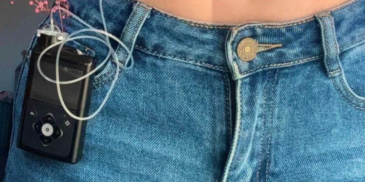 Quartu, mesi di attesa per un microinfusore salvavita: la denuncia di Camilla, 29 anni