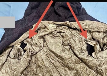 Manuela Murgia, la famiglia mostra il giubbotto strappato: “Dettagli che non sono solo dettagli”