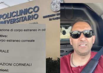 Monserrato, dopo due giorni di agonia è terminato il calvario di Emanuele Scalas: rimossa la scheggia di ferro dalla cornea