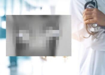 Intervento al seno non riuscito, scatta il maxi risarcimento per una giovane donna cagliaritana: 30 mila euro