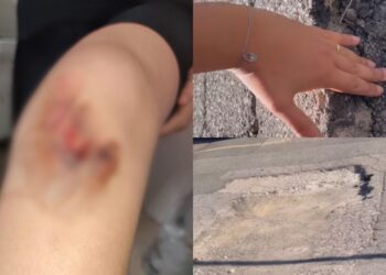 Solanas, bimba inciampa e cade in una maxi voragine
