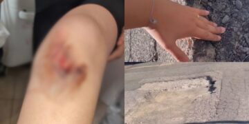 Sinnai, bimba inciampa e cade in una maxi voragine