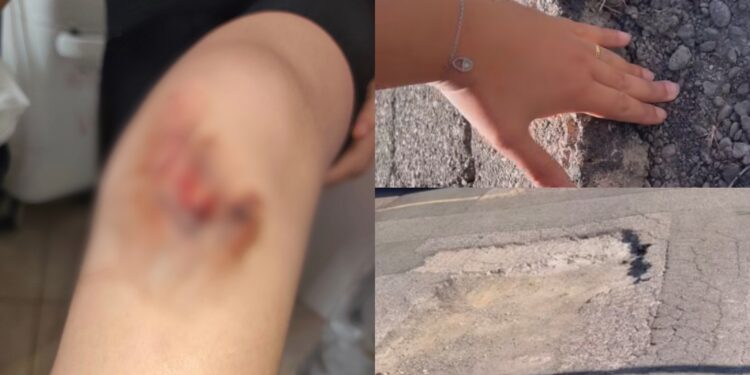Sinnai, bimba inciampa e cade in una maxi voragine