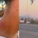 Ragazzini aggrediti al Poetto di Quartu: “Una rissa e tanti episodi di vandalismo, qui è il far west”