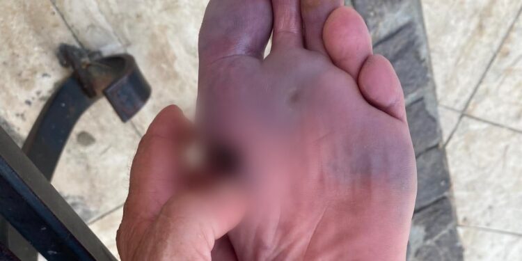 Cagliari, odissea alla guardia medica: per accedere occorre telefonare ma la linea è occupata da internet