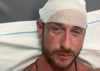 “Aggredito e picchiato da 30 persone sulla spiaggia in Sardegna perché gay”: la denuncia choc diventa un caso
