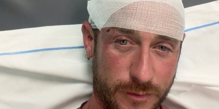 “Aggredito e picchiato da 30 persone sulla spiaggia in Sardegna perché gay”: la denuncia choc diventa un caso