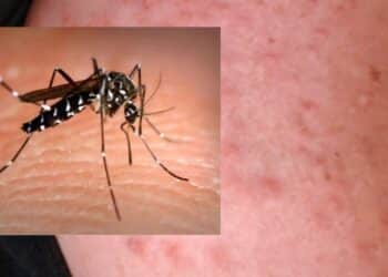 West Nile, aumentano i casi in Sardegna e sale la preoccupazione nel Medio Campidano dopo un decesso e un contagio a San Gavino