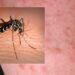 West Nile, aumentano i casi in Sardegna e sale la preoccupazione nel Medio Campidano dopo un decesso e un contagio a San Gavino