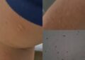 Cagliari, ancora cimici nel dormitorio di via Ospedale: materassi nuovi già infestati (VIDEO)